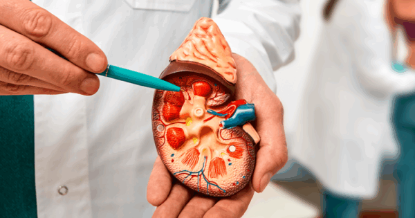 cancer renal